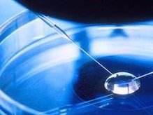 郑州地区有哪些私立的机构可以做试管技术？调理月经量少的5个小偏方