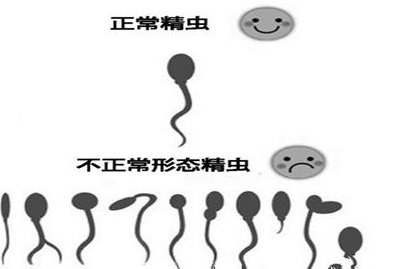 详细解读侯马市做长方案试管婴儿费用，长方案和短方案成功率有差别吗？