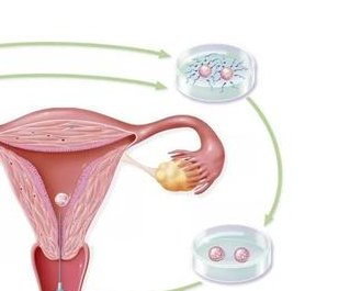 在广元市做试管婴儿长方案周期需要多久？超长方案促排流程是怎么样的？